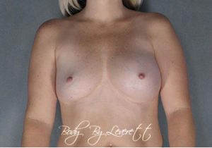 Body by Leverett Before and After Images