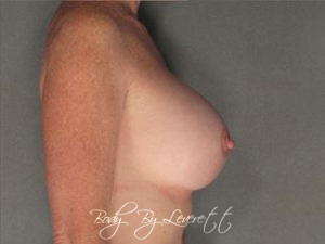 Body by Leverett Before and After Images