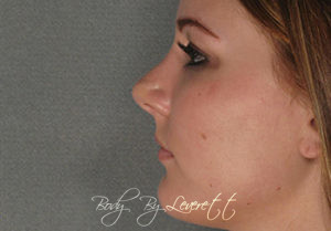 Body by Leverett Before and After Images