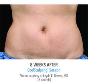 Body by Leverett Before and After Images